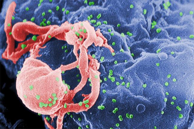 HIV tarih oluyor! Bilim dünyası bu keşfi konuşuyor