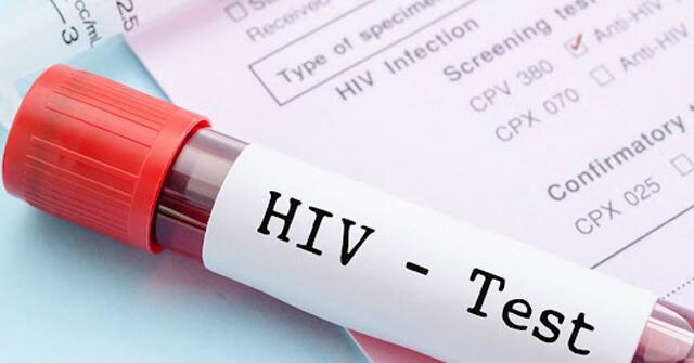 HIV tarih oluyor! Bilim dünyası bu keşfi konuşuyor