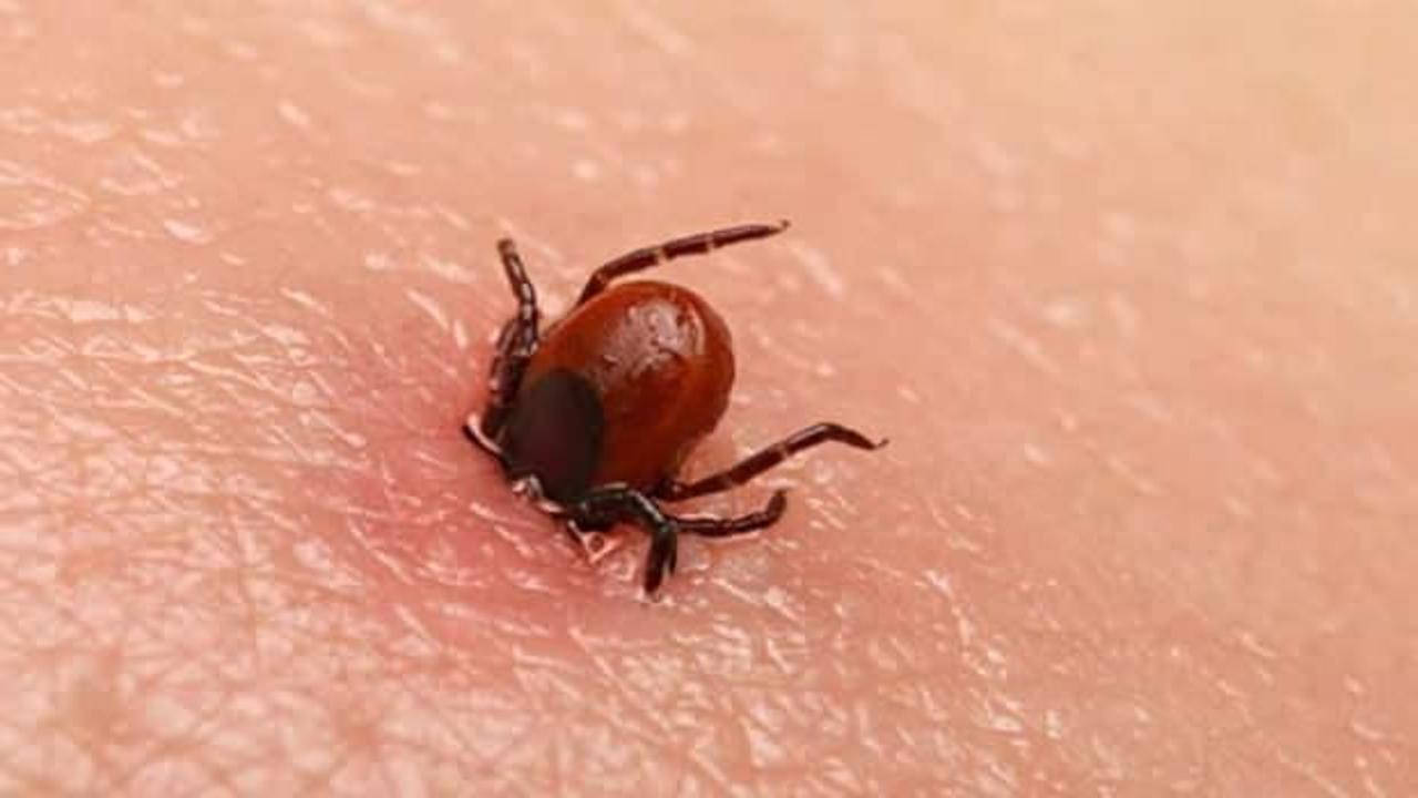 Kene ısırığı durumunda ne yapmalıyız? Keneden korunma yolları nelerdir?