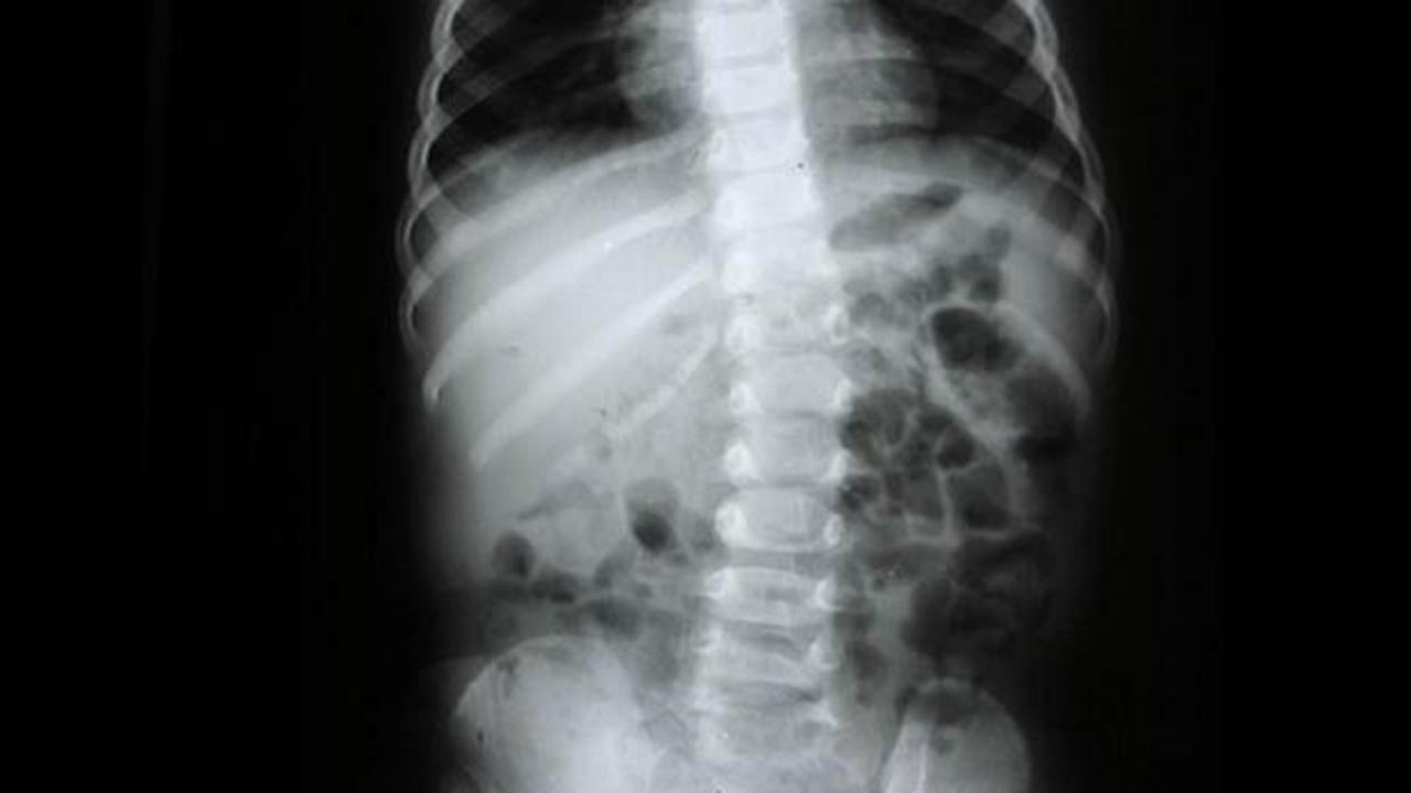 Omurga sağlığı için nelere dikkat edilmeli? Uzman isim açıkladı